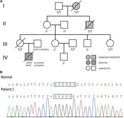 Case Report: Identification of Mutations in LAMP2 in Two Chinese Infants With Danon Disease